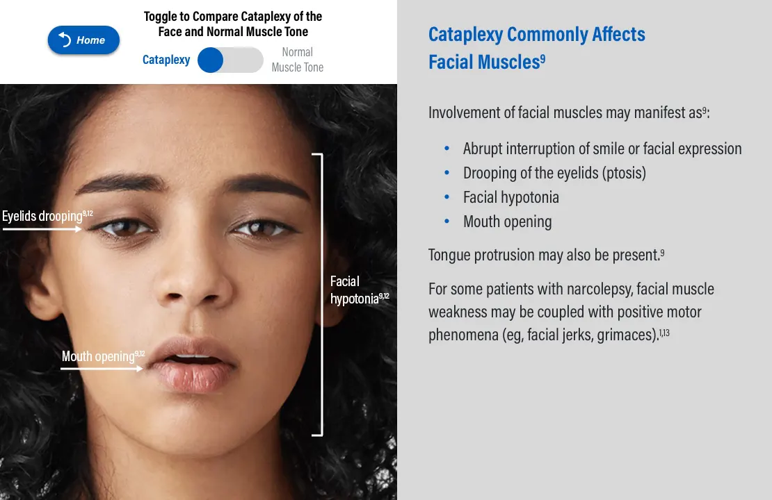 Interactive cataplexy tool thumbnail